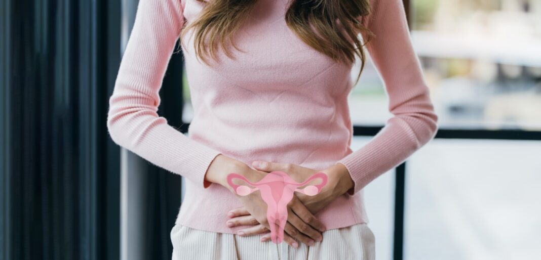 Femme infectée par un papillomavirus