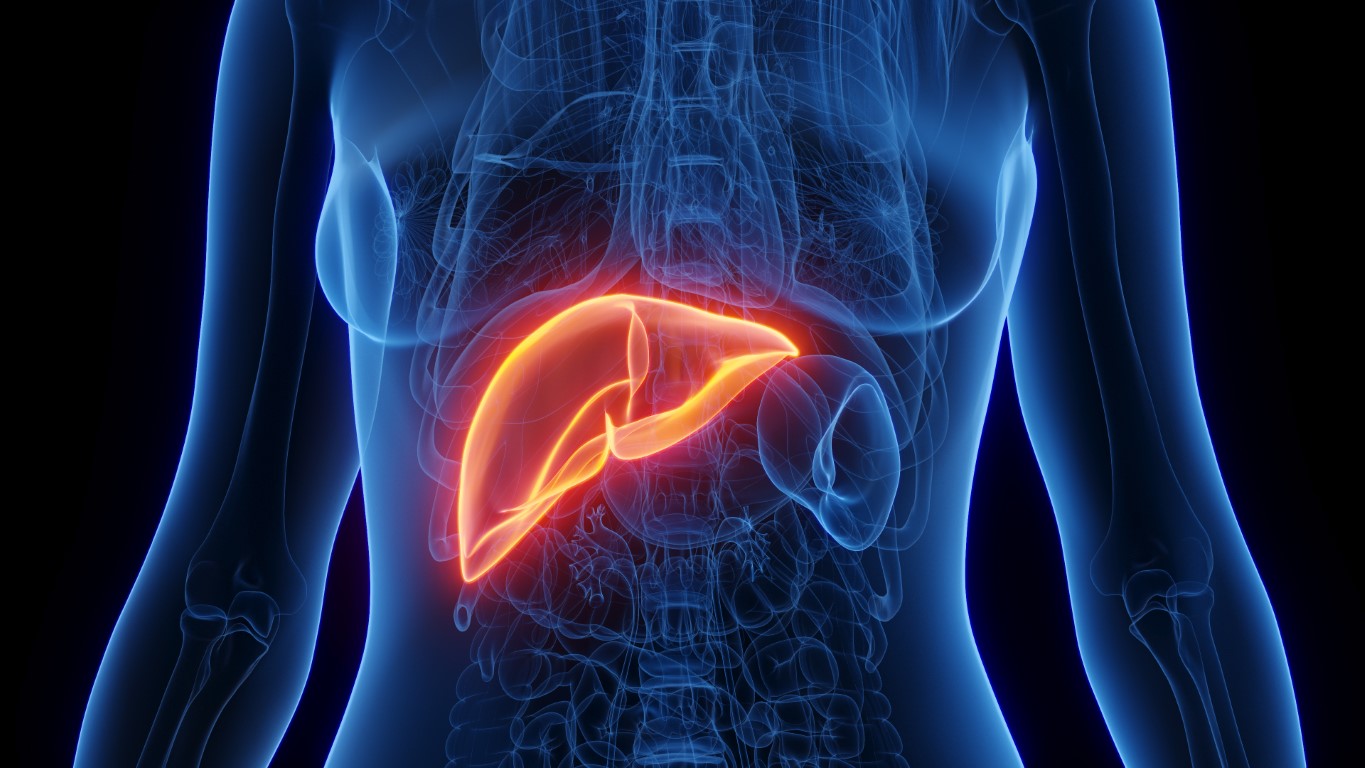 Bilirubine totale basse : causes et symptômes - News Santé