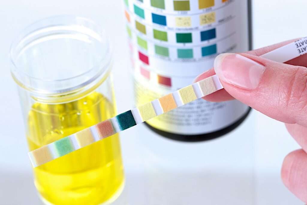Effectuer un test urinaire en cas de crise d'acétone