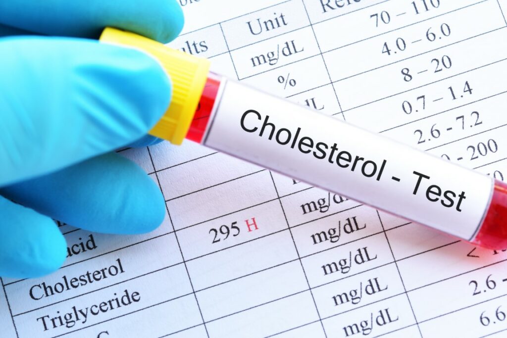 Faire une prise de sang pour mesurer le taux de cholestérol