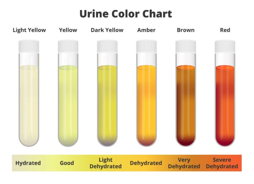 Les différentes couleurs d'urine