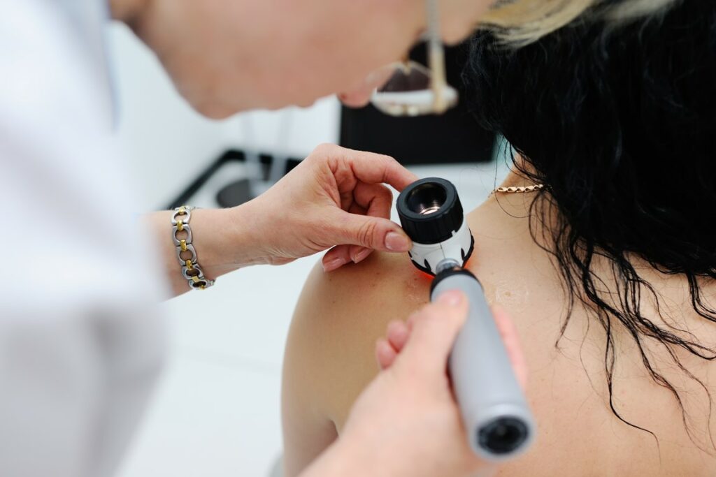Consulter un dermatologue en cas d'apparition soudaine de point rubis