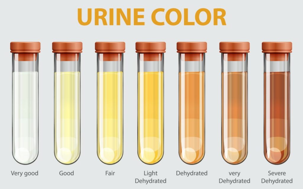 Les différentes couleurs de l'urine