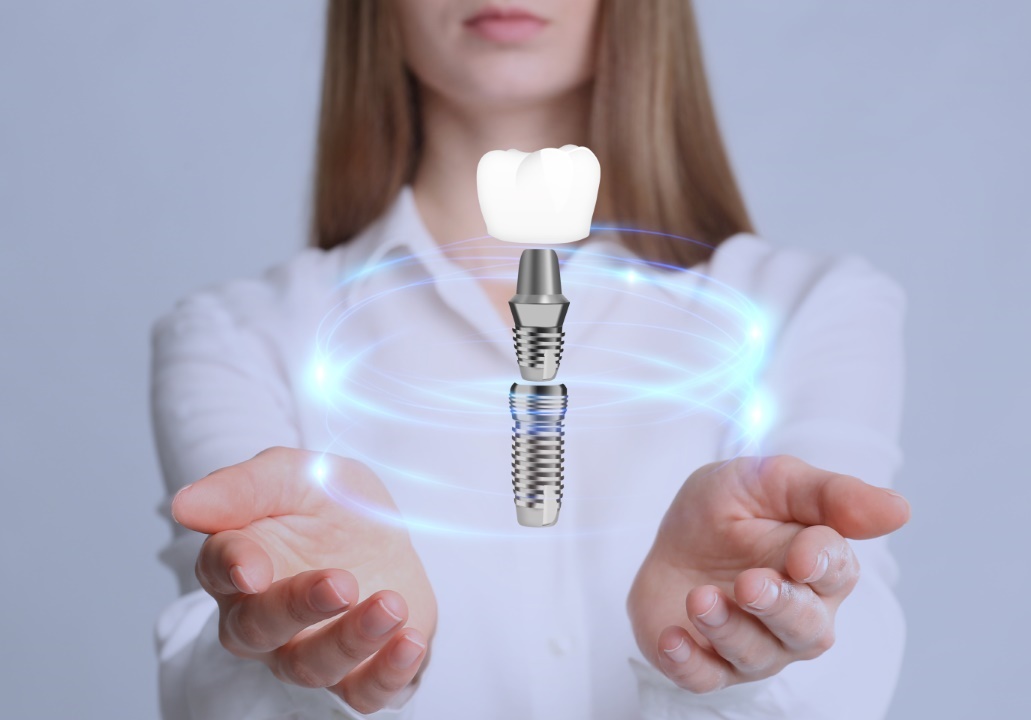 Les avantages de l'implantologie dentaire : une solution durable et esthétique pour remplacer les dents manquantes