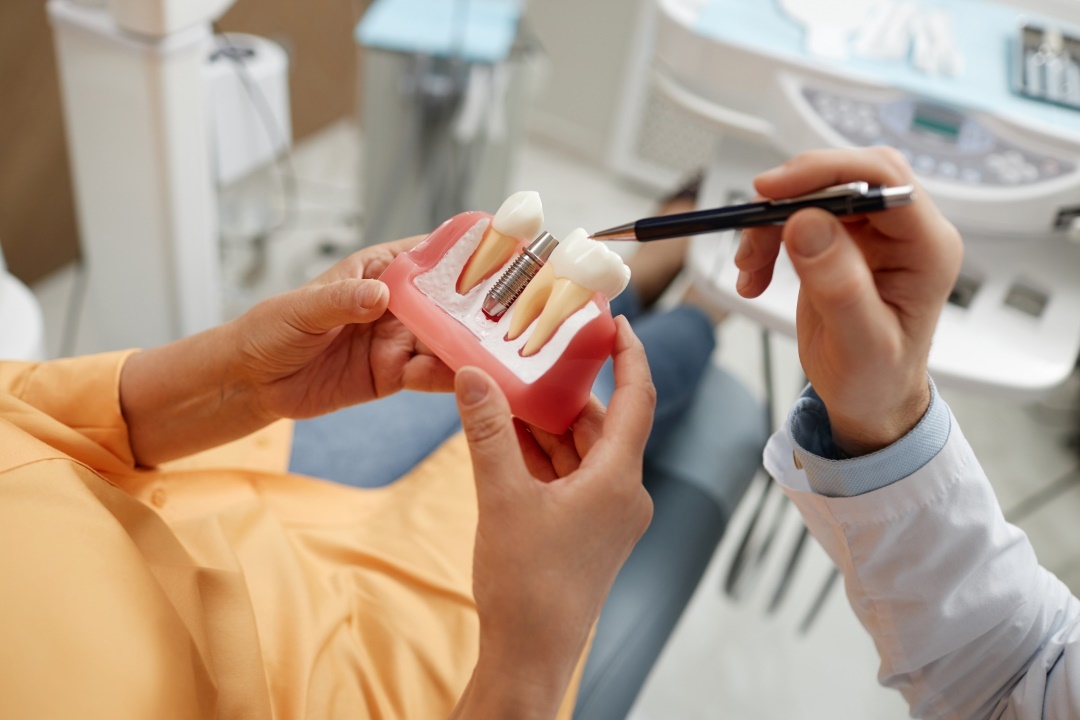 Les avantages de l'implantologie dentaire : une solution durable et esthétique pour remplacer les dents manquantes