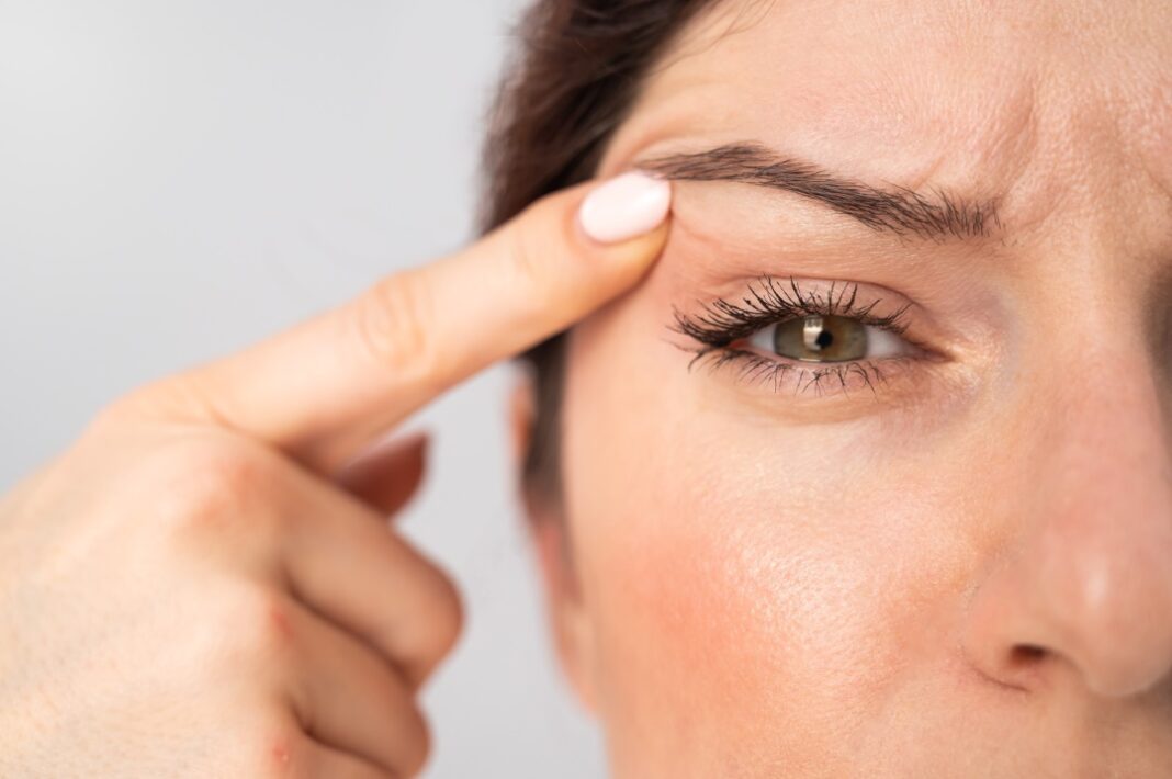 Blépharoplastie corriger paupières tombantes