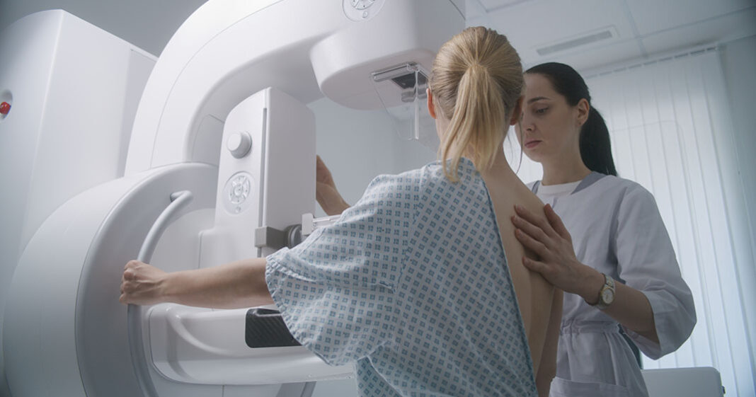 L'âge de la première mammographie pourrait être accéléré pour des raisons de santé